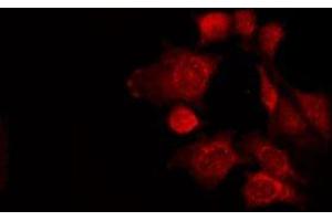 ABIN6275427 staining LOVO by IF/ICC. (PWWP2B Antikörper  (Internal Region))