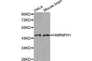Western blot analysis of extracts of various cell lines, using HNRNPH1 antibody (ABIN5973515). (HNRNPH1 Antikörper)