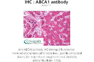 Image no. 1 for anti-ATP-Binding Cassette, Sub-Family A (ABC1), Member 1 (ABCA1) antibody (ABIN1731401)