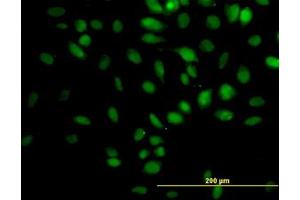 Image no. 5 for anti-Tripartite Motif Containing 33 (TRIM33) (AA 1006-1106) antibody (ABIN599250) (TRIM33 Antikörper  (AA 1006-1106))