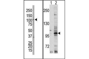 (LEFT)Western blot analysis of anti-EphA7 Pab in NCI-H460 cell lysate. (EPH Receptor A7 Antikörper  (C-Term))