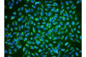 IF analysis of ALDH2 using anti-ALDH2 antibody (ABIN7603122). (ALDH2 Antikörper  (N-Term))