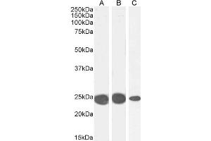 ABIN185491 (0. (CBX5 Antikörper  (Internal Region))