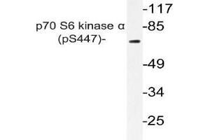 Western blot (WB) analyzes of p-p70 S6 kinase alpha antibody in extracts from A549 PMA cells. (RPS6KB1 Antikörper  (pSer447))