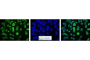 Image no. 5 for anti-DNA Repair Protein Apurinic Endonuclease antibody (ABIN5693483) (DNA Repair Protein Apurinic Endonuclease Antikörper)