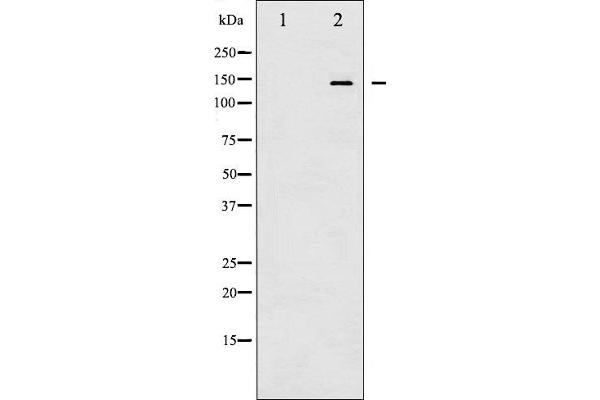 CASR Antikörper  (pThr888)