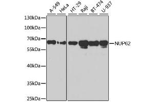Western blot analysis of extracts of various cell lines, using NUP62 antibody. (NUP62 Antikörper)