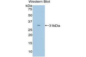 Western Blotting (WB) image for anti-Myosin IE (MYO1E) (AA 772-1033) antibody (ABIN1078394) (MYO1E Antikörper  (AA 772-1033))
