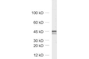 dilution: 1 : 1000, sample: rat brain homogenate (Homer 1/2/3 (N-Term) Antikörper)