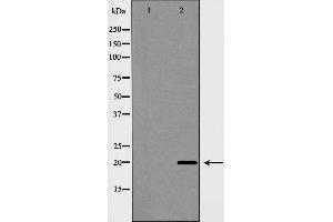 Western blot analysis of Caveolin 1 expression in HuvEc cell extracts. (Caveolin-1 Antikörper  (C-Term))
