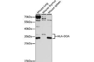 Western blot analysis of extracts of various cell lines, using HLA-DOA antibody (ABIN7267757) at 1:1000 dilution. (HLA-DOA Antikörper  (AA 26-217))