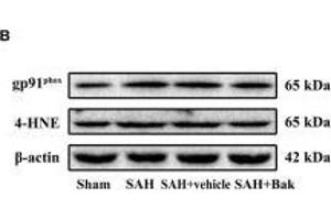 The effect of Bak on the oxidative stress 24 h after SAH. (beta Actin Antikörper  (AA 1-375))
