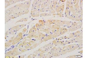 Formalin-fixed and paraffin embedded rat heart labeled with Anti-factor V Polyclonal Antibody, Unconjugated  at 1:200 followed by conjugation to the secondary antibody and DAB staining. (Factor 5 (AA 301-400) Antikörper)