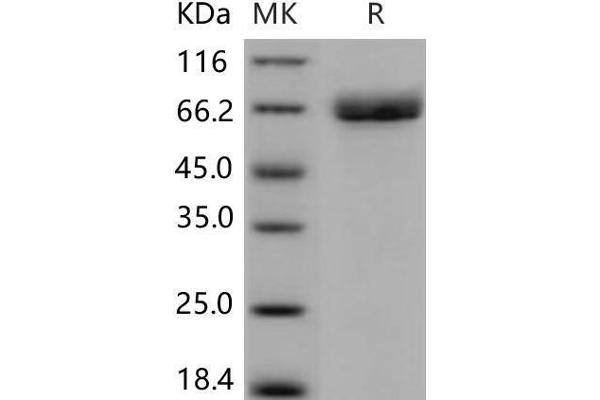 Acetylcholinesterase Protein (AChE) (His tag)