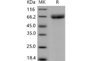 Western Blotting (WB) image for Acetylcholinesterase (AChE) (Active) protein (His tag) (ABIN7194089)