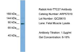 WB Suggested Anti-TTC27  Antibody Titration: 0. (TTC27 Antikörper  (N-Term))