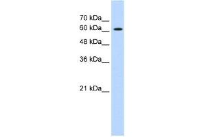 WB Suggested Anti-ZIC2 Antibody Titration:  0. (ZIC2 Antikörper  (C-Term))