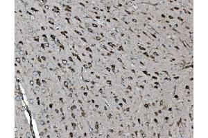 IHC analysis of INPPL1 using anti-INPPL1 antibody (ABIN7599785).