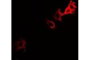 Immunofluorescent analysis of PGM1 staining in U2OS cells. (Phosphoglucomutase 1 Antikörper)