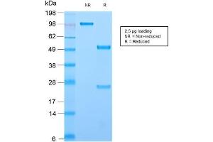 SDS-PAGE Analysis Purified CD44 Rabbit Recombinant Monoclonal Antibody (HCAM/2875R).