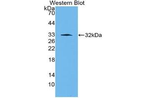 Western blot analysis of the recombinant protein. (PAI1 Antikörper  (AA 141-389))