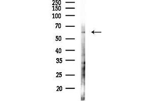 Western blot analysis of lysates from HUVEC cells(starvation 24h treatment), using MMP9 Antibody at 1/1000 dilution.