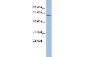 WB Suggested Anti-ZNF502 Antibody Titration:  0. (ZNF502 Antikörper  (N-Term))