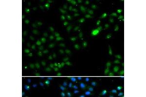 Immunofluorescence analysis of HeLa cells using FKBP3 Polyclonal Antibody (FKBP3 Antikörper)