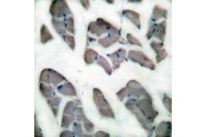 Immunohistochemistry analysis of paraffin-embedded human skeletal muscle tissue, using Desmin Antibody. (Desmin Antikörper  (AA 421-470))