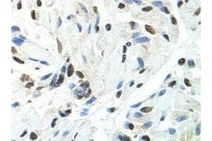Immunohistochemistry (IHC) image for anti-Splicing Factor Proline/glutamine-Ric (SFPQ) antibody (ABIN1874752) (SFPQ Antikörper)