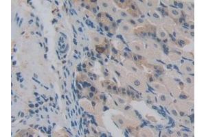 Detection of NUP85 in Mouse Stomach Tissue using Polyclonal Antibody to Nucleoporin 85 (NUP85) (NUP85 Antikörper  (AA 418-653))