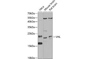 Western blot analysis of extracts of various cell lines, using VHL antibody (ABIN3020967, ABIN3020968, ABIN3020969 and ABIN6213828) at 1:1000 dilution. (VHL Antikörper  (AA 1-172))