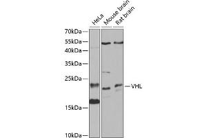 Western blot analysis of extracts of various cell lines, using VHL antibody (ABIN3020967, ABIN3020968, ABIN3020969 and ABIN6213828) at 1:1000 dilution.