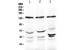 Western blot analysis of Exportin-5 using anti-Exportin-5 antibody .
