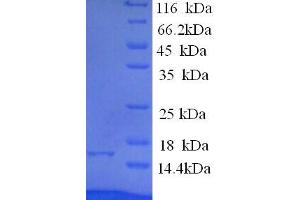 Eukaryotic Translation Initiation Factor 4E Binding Protein 2 (EIF4EBP2) (AA 1-120), (full length) protein (His tag)
