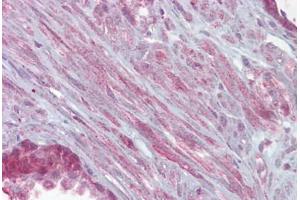 Immunohistochemistry (IHC) image for anti-Potassium Large Conductance Calcium-Activated Channel, Subfamily M, alpha Member 1 (KCNMA1) (AA 1080-1129) antibody (ABIN6748500)