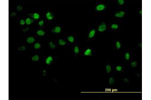Immunofluorescence of monoclonal antibody to AKT2 on HeLa cell.