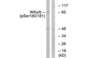 Western blot analysis of extracts from HepG2 cells treated with TNF 20ng/ml 5', using IKK-alpha/beta (Phospho-Ser180/181) Antibody. (IKK-alpha /IKK-beta Antikörper  (pSer180))