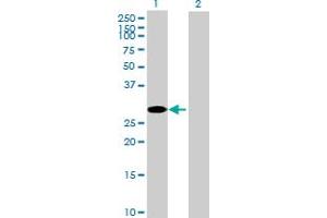 Western Blot analysis of CCS expression in transfected 293T cell line by CCS MaxPab polyclonal antibody. (Superoxide dismutase copper chaperone Antikörper  (AA 1-274))