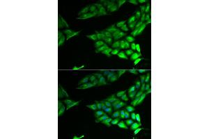 Immunofluorescence analysis of U2OS cells using PSAT1 antibody. (PSAT1 Antikörper)