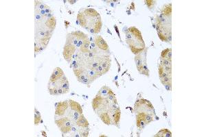 Immunohistochemistry of paraffin-embedded human gastric using MYLK antibody at dilution of 1:100 (x40 lens). (MYLK Antikörper)