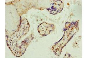 Immunohistochemistry of paraffin-embedded human placenta tissue using ABIN7144350 at dilution of 1:100 (AP1M1 Antikörper  (AA 1-160))