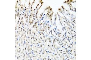 Immunohistochemistry of paraffin-embedded mouse stomach using YTHDF3 antibody.