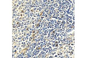 IHC analysis of MPO using anti-MPO antibody (ABIN7602030). (Myeloperoxidase Antikörper  (AA 556-697))