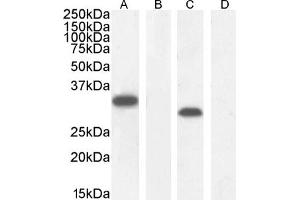 Western Blotting (WB) image for anti-Myeloid Differentiation Primary Response Gene (88) (MYD88) (Internal Region) antibody (ABIN185362)