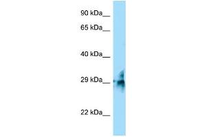WB Suggested Anti-TMUB2 Antibody Titration: 1. (TMUB2 Antikörper  (C-Term))