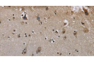 Immunohistochemistry of paraffin-embedded Human brain using GYS1 Polyclonal Antibody at dilution of 1:50