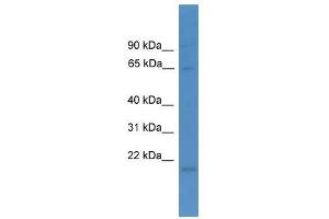 Western Blot showing LTA4H antibody used at a concentration of 1-2 ug/ml to detect its target protein.