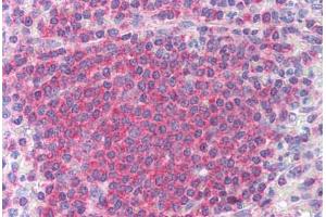 Human Spleen (formalin-fixed, paraffin-embedded) stained with CHEK2 antibody ABIN213892 at 10 ug/ml followed by biotinylated anti-mouse IgG secondary antibody ABIN481714, alkaline phosphatase-streptavidin and chromogen. (CHEK2 Antikörper)