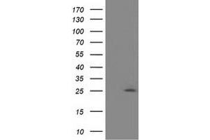 Western Blotting (WB) image for anti-Adenylate Kinase 3 (AK3) antibody (ABIN1496519) (Adenylate Kinase 3 Antikörper)